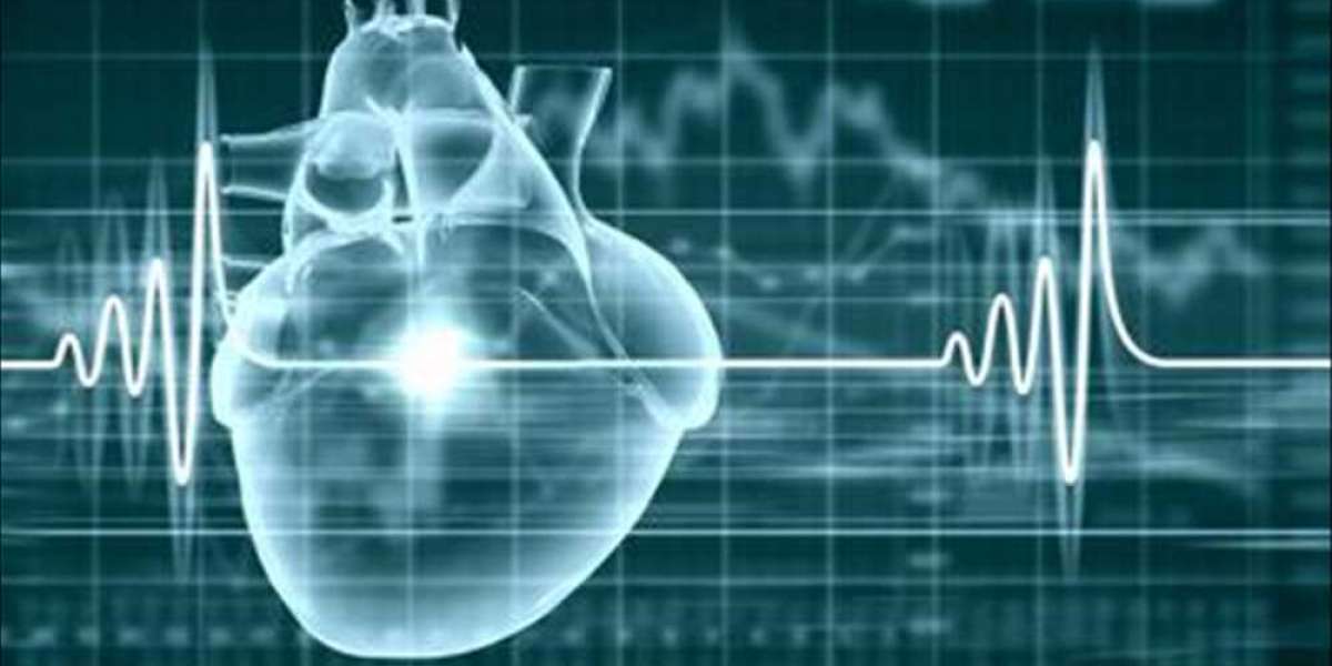 Global Electrophysiology Market by Size, Drivers, Restraints, and Opportunities